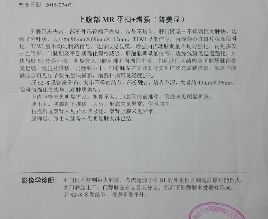 中肿影像报告