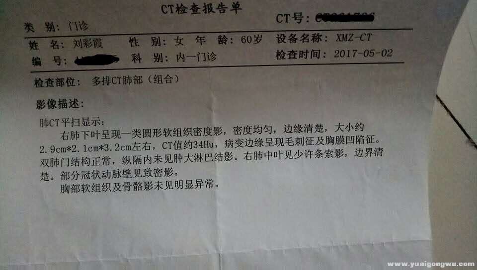 第一次ct结果.jpg