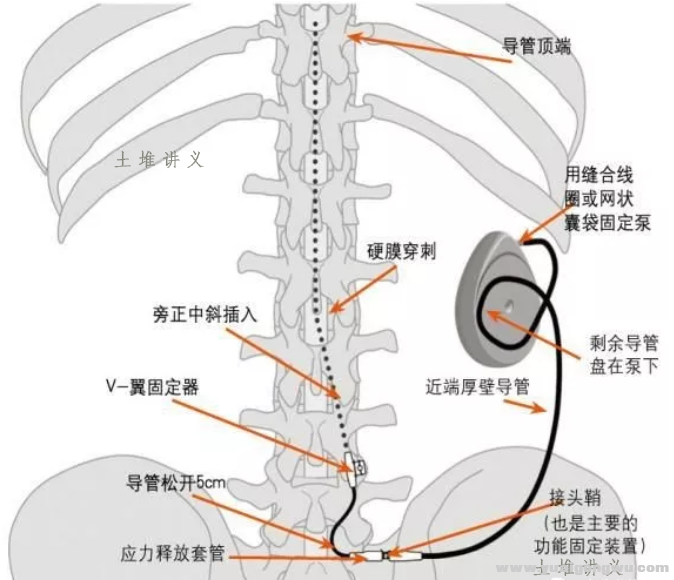 微信图片_20200506140520.png