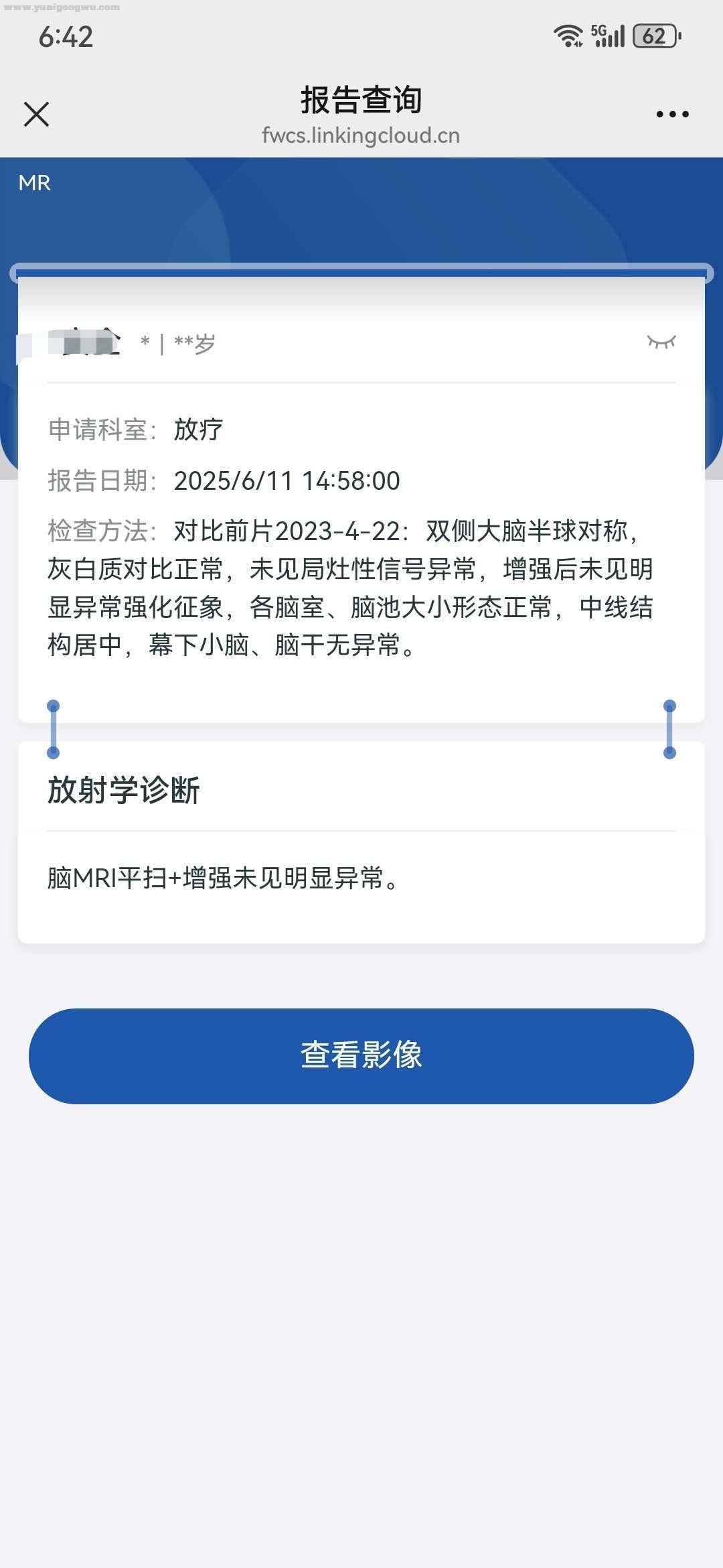 根治性放疗结束后，免疫维持两年能不能停药？
